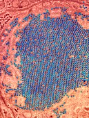 St. Louis encephalitis virus particles