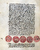Foetal presentations,15th century