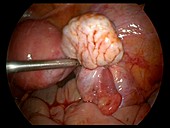 Ovary,endoscope view