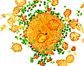 Budding HIV particles,TEM