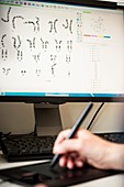 Genetic karyotype analysis