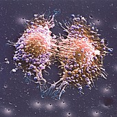 Cancer cell division,SEM
