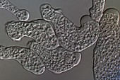 Entamoeba histolytica protozoa
