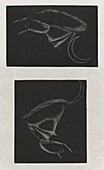 Phosphenes and retinal images,1853