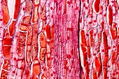 Pine cone tissue,light micrograph
