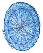 Radish hypocotyl,light micrograph