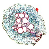 Sunflower root,light micrograph