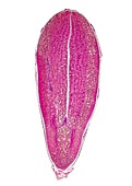 Thornapple seed,light micrograph