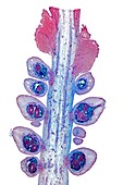Cuckoo-pint flower stalk,micrograph