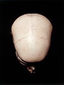 Female human skull