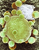 Lymphocyte attacking cancer cell,SEM
