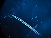 Meloidogyne nematode,light micrograph