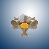 Cervical vertebra (C4),artwork