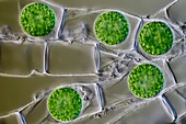 Algal cysts,light micrograph