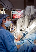 Laparoscopic robotic cancer surgery