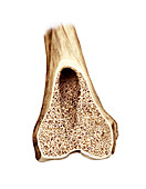 Frontal section of the femur,artwork