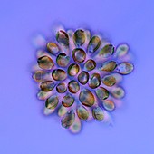 Synura golden algae,light micrograph
