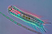 Gastrotrich,light micrograph