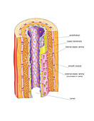 Vascular anastomosis,artwork