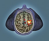 Healthy brain,fMRI scan