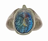 Healthy brain,3D MRI scan
