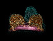 Breast arteries,MRA scan