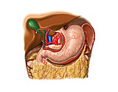 Arterial system of stomach,artwork