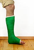 Broken ankle in a cast