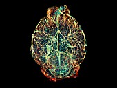 Mouse brain blood vessels,OPT