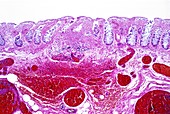 Intestinal ischaemia,light micrograph