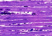 Skeletal muscle fibres,light micrograph