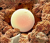 Sunscreen microsphere,SEM