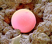 Sunscreen microsphere,SEM