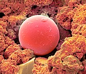 Sunscreen microsphere,SEM