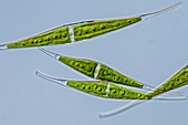 Closterium sp. green alga,LM