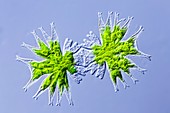 Micrasterias furcata green alga,LM