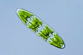 Planotaenium sp. green alga,LM