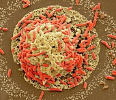 E. coli induced cell death,SEM