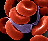 Trypanosome amongst blood cells,SEM