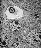 Pancreatic islet cells,TEM