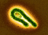 Ebola virus particle,TEM