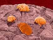 Sarcoptes parasitic mites,ESEM