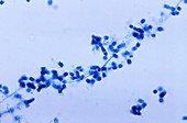 Coccidioidomycosis fungus,micrograph