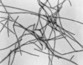 Microtubules,TEM