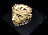 Head and brain model,18th century