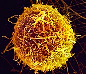 Ebola virus budding from cell,SEM