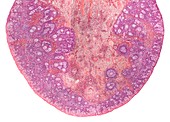 Ovary of a child,LM