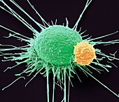 T lymphocyte and cancer cell,SEM