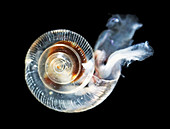 Ocean acidity dissolving snail shell