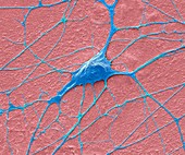 Motor neurone,SEM